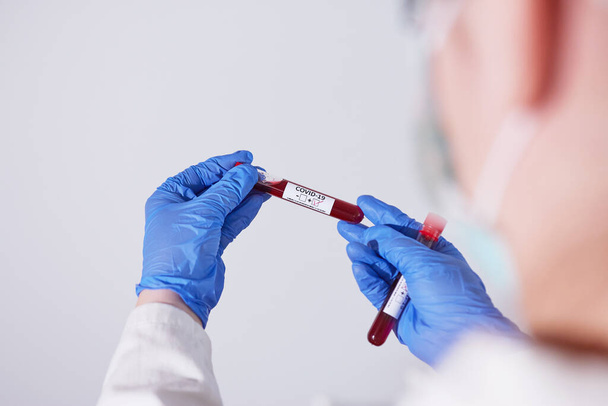 Tube d'échantillon de sang de coronavirus tenu par le médecin portant un masque protecteur et des gants - Photo, image