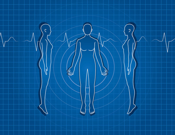 Απεικόνιση του ανθρώπινου σώματος. Γυναικείο σκίτσο - Διάνυσμα, εικόνα