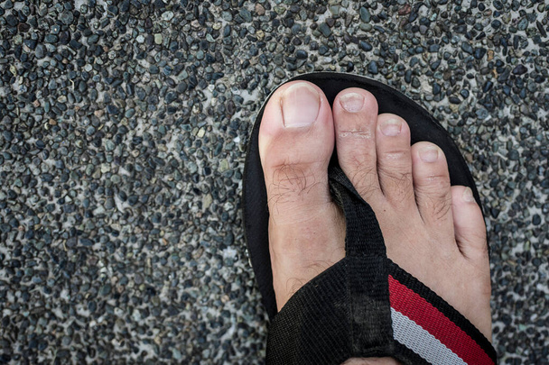 Ein Fuß mit leichtem Fußekzem an den Zehen. Ungepflegte und ungeschnittene Fußnägel. - Foto, Bild
