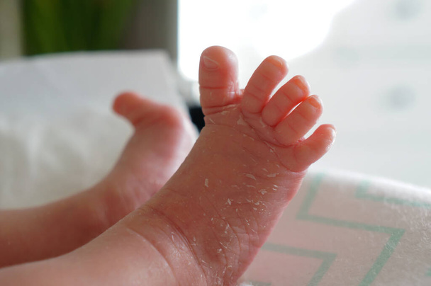  pink legs of a newborn peeling skin - Photo, Image