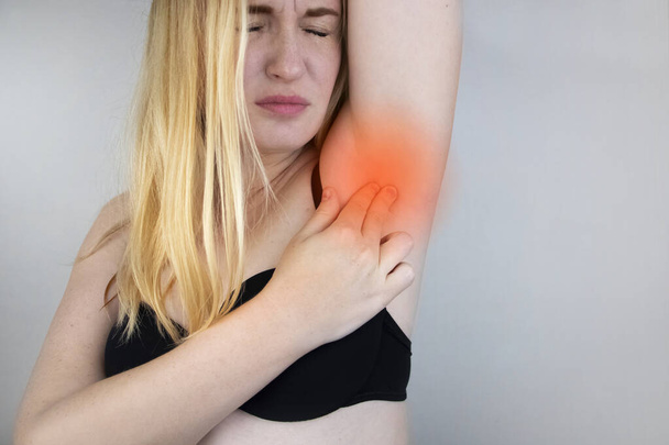 Eine Frau leidet unter Schmerzen in der Achselhöhle. Schweißausbrüche, unangenehmer Geruch, Rötungen, Zähne und Entzündungen in der Achselhöhle. Brustkrebs-Präventionskonzept - Foto, Bild