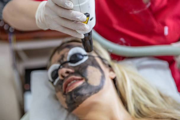 Procedura łuszczenia twarzy węglem. Laserowe impulsy oczyszczają skórę twarzy. Leczenie kosmetologiczne sprzętu. Proces fototermolizy, rozgrzewanie skóry, laserowe obieranie węgla. Odmładzanie skóry twarzy. - Zdjęcie, obraz