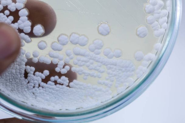 Antecedentes de las características de colonias de hongos y algas en placas de Petri para la educación
. - Foto, Imagen
