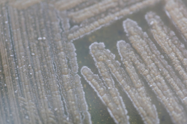 Antecedentes de las características de colonias de hongos y algas en placas de Petri para la educación
. - Foto, Imagen