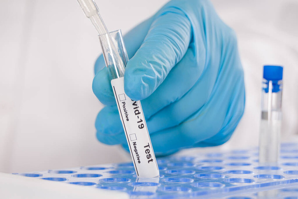 Fechar as mãos com luvas azuis segurando um tubo de ensaio após análise do vírus com marcadores de resultado (de anticorpos)
 - Foto, Imagem