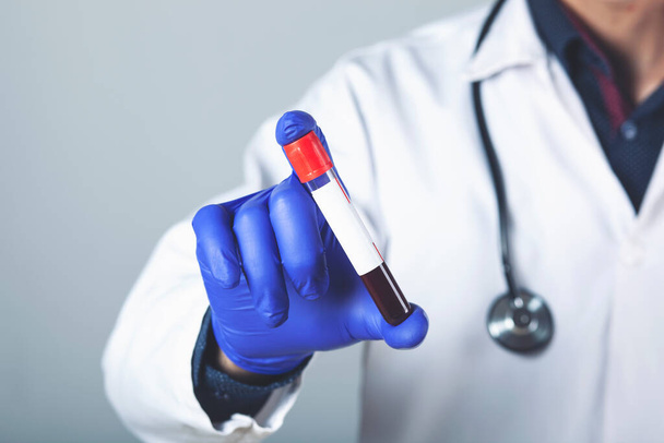 Giovane medico che tiene fiala con medicamento rosso isolato su grigio
 - Foto, immagini