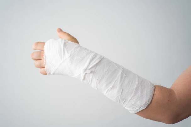 A mans broken arm in a white plaster bandage warms up his injured fingers close-up - Photo, Image
