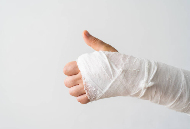 The broken arm of a man in gypsum shows the like with his thumb. Positive mood for early recovery fracture arm - 写真・画像