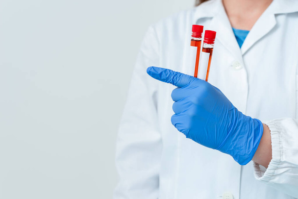 Henkilö, jolla on lääketieteelliset käsineet suorittavaan laboratoriokokeeseen. Holding Test Tube Of Blood For Health Kuntoanalyysi - Valokuva, kuva