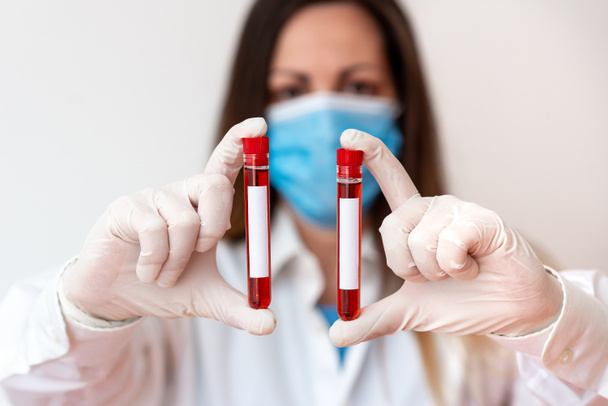 Pessoa vestindo luvas de vestido médico para a realização de experimentos de laboratório. Segurando tubo de teste de sangue para análise de condição de saúde
 - Foto, Imagem