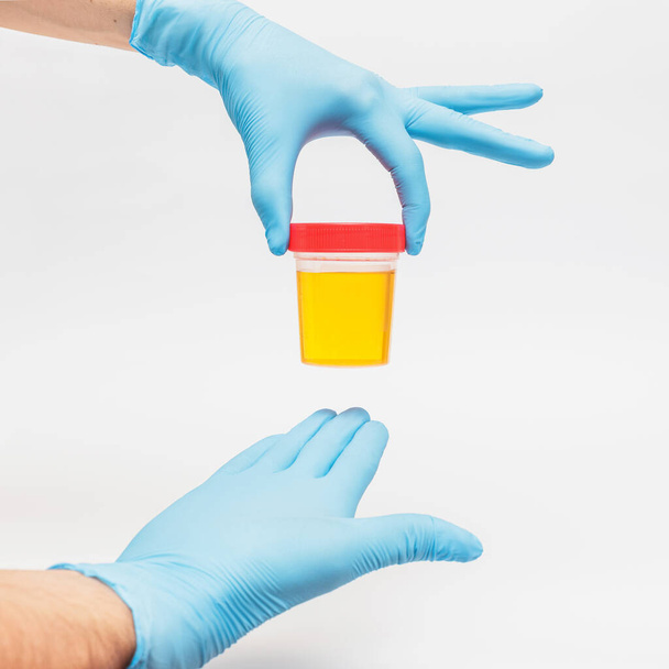 Urinprobenanalyse in einem Glas in Handschuhen durch einen Arzt oder einen Biolabor-Mitarbeiter. Urologie und Nierenerkrankungen und Harnwegsinfektionen Konzept. - Foto, Bild
