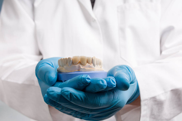 close-up van de hand van de tandtechnicus in handschoenen die een tandafdruk met kunstmatige tandheelkunde klaar voor gebruik presenteren - Foto, afbeelding