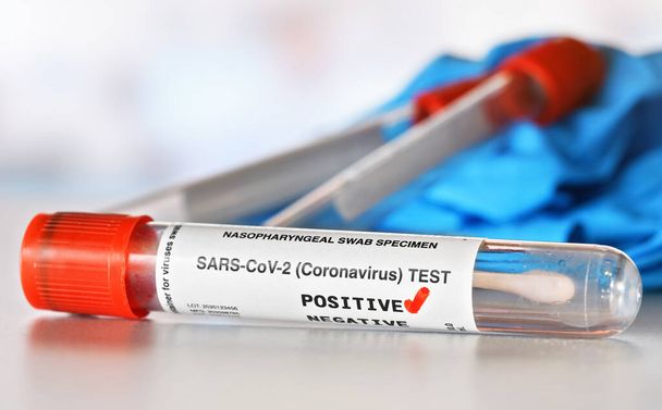 Coronavirus test concept - vial sample tube with cotton swab, red checkmark next to word positive, blurred vials and blue nitrile gloves background. (Sticker is own design with dummy data) - 写真・画像