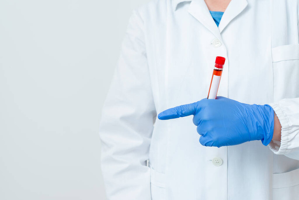 Osoba nosící lékařské rukavice pro provádění laboratorního experimentu. Pořádání zkumavky krve pro analýzu zdravotního stavu - Fotografie, Obrázek