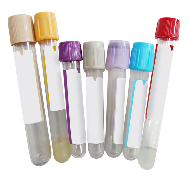 Set of Color Coded Blood Test Vials with Clipping Path - Foto, immagini