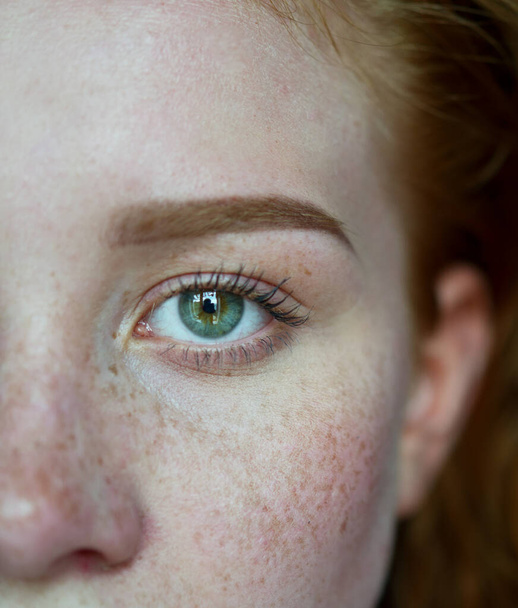 Mitad de cara de mujer con ojo verde y pecas
 - Foto, imagen