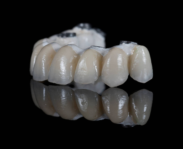 Keramische tanden kronen model op zwarte achtergrond.  - Foto, afbeelding