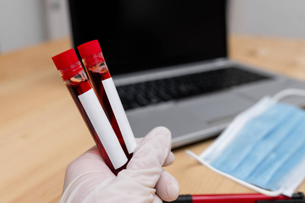 Analysointi laboratorio Test Tube louhittu ihmisen verinäyte moderneilla laitteilla vempaimia kannettava tietokone terveysriskin diagnostinen työkalu - Valokuva, kuva