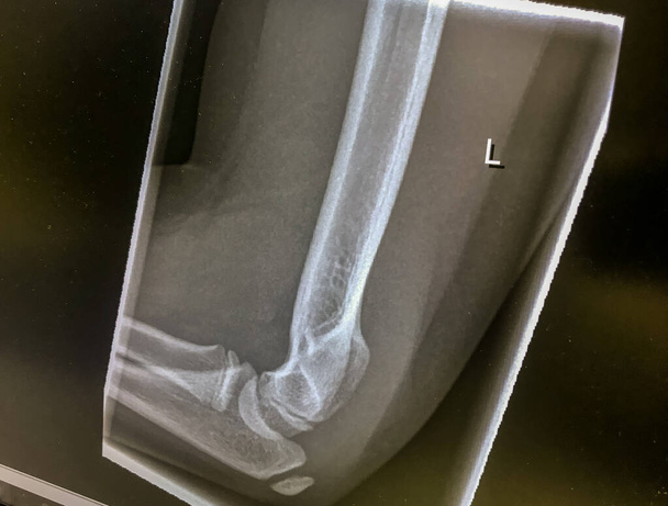 Imagen de rayos X de un ortopedista
 - Foto, imagen