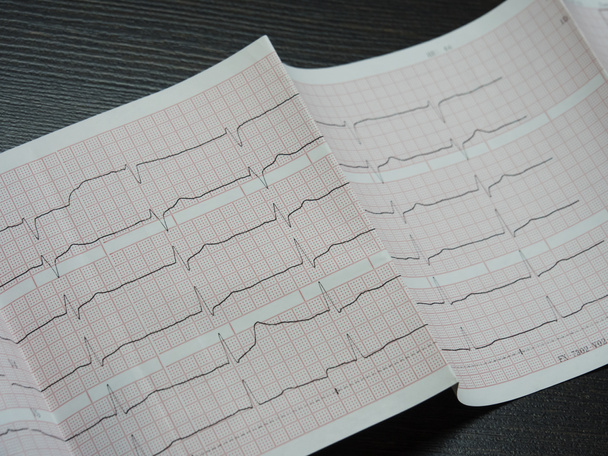 Elektrokardiográfia szív fehér papíron vörös sejtekkel, közelkép szögben. - Fotó, kép