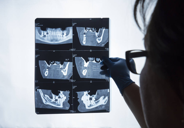 Une femme blanche médecin examine une photographie par rayons X d'une mâchoire d'homme. - Photo, image
