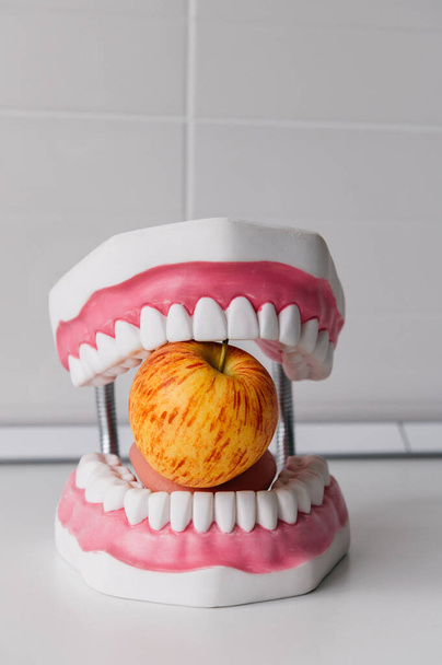 リンゴと顎の歯科モデル。歯の音 - 写真・画像