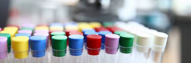 Tubos de ensaio com tampas coloridas estão em laboratório
 - Foto, Imagem