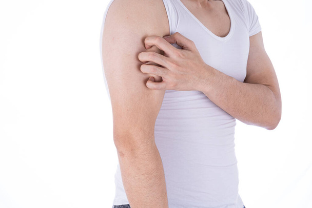 Egy férfi karmolja a karját elszigetelt fehér háttéren. Orvosi, egészségügyi reklám koncepció. - Fotó, kép