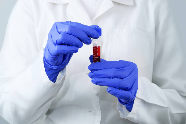 Laboratory doctor with close-up test tube of blood tests in hands on white background. - Foto, immagini