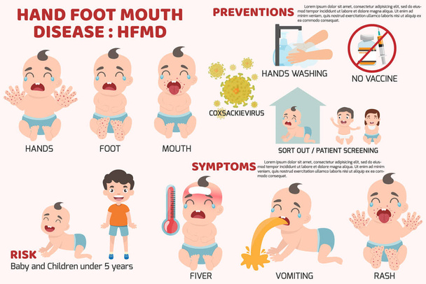 MKS-Kinder infiziert. Poster Detail der Hand-Fuß-Mund-Krankheit Infografiken mit Symptomprävention und -behandlung. Cartoon Gesundheitskonzept Vektor Illustration. - Vektor, Bild