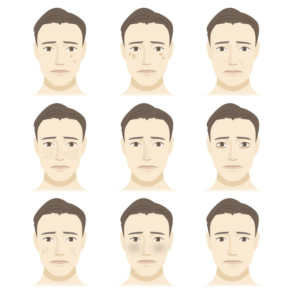 Mannen gezicht huidproblemen illustratie set - Vector, afbeelding