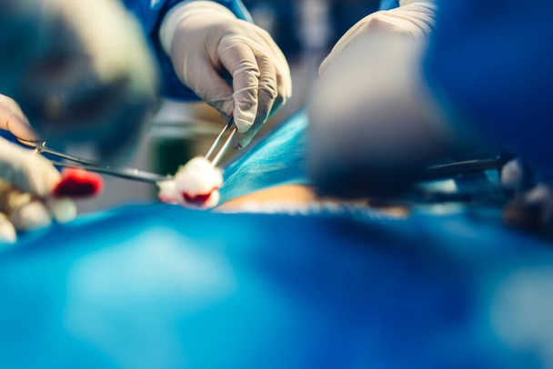 専門麻酔科医師チームと現代病院手術緊急治療室で手術機器を使用して手術を行う婦人科手術の患者を準備アシスタント - 写真・画像