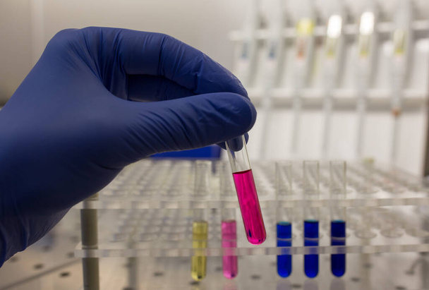 Laboratuvarda kimyasallarla deney tüpü tutan koruyucu eldivenlerle biyolog elini kapat. - Fotoğraf, Görsel