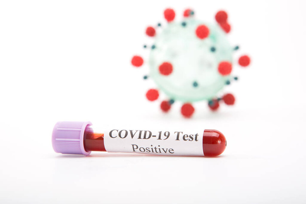 Test tube with a positive COVID-19 test on a white background - Zdjęcie, obraz