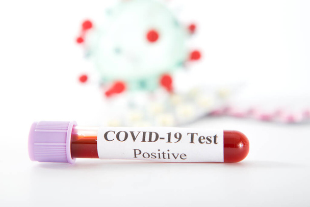 Test tube with a positive COVID-19 test on a white background - Photo, image