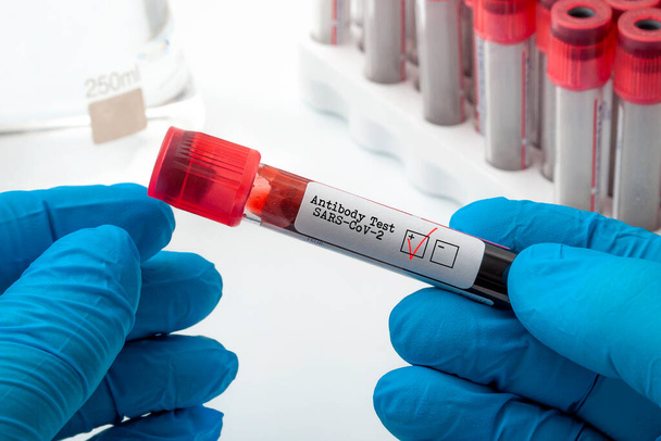 Novo teste de anticorpos clínicos coronavírus e conceito de diagnóstico Covid-19 com médico segurando amostra de plasma de sangue usado para testar o antígeno SARS-CoV-2 com um cheque vermelho na caixa positiva - Foto, Imagem