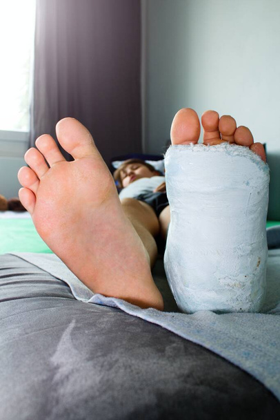 詳細足-白い石膏で左足や足.石膏で壊れた足.男の子は足首が折れてる. - 写真・画像