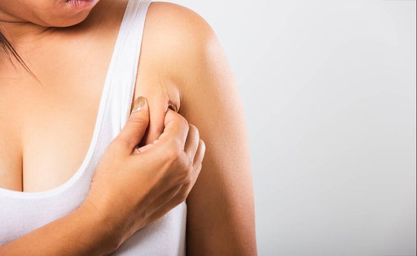 woman pulling her skin underarm she problem armpit fat underarm  - Photo, image
