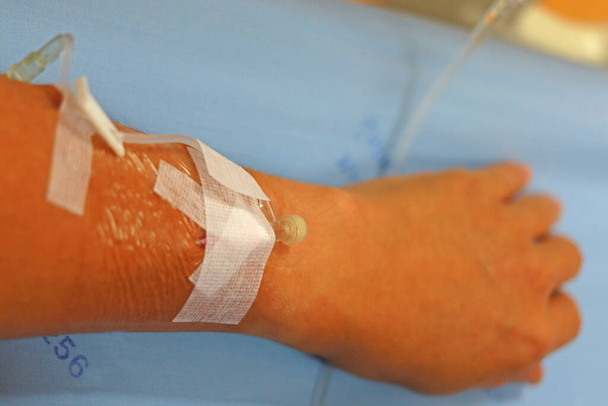 Der Arm des Patienten legt sich auf das Krankenhausbett mit Infusionsset aus Kunststoff oder Tropfset, Krankenversicherungs-Konzept. Selektiver Fokus - Foto, Bild