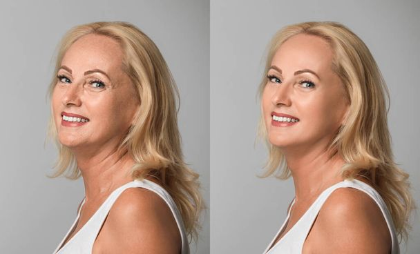 Mature woman before and after cosmetic procedure on grey background  - Foto, Imagem