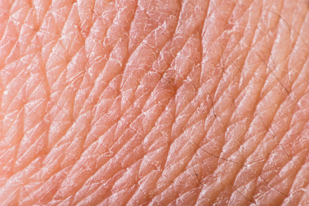 Textur der menschlichen Haut - Foto, Bild