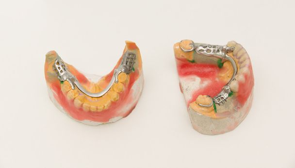 Protezy dentystyczne - Zdjęcie, obraz