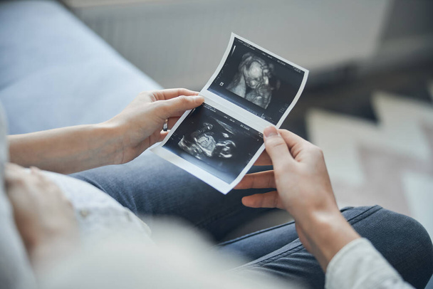 Hands of man and woman holding baby scan picture - Valokuva, kuva
