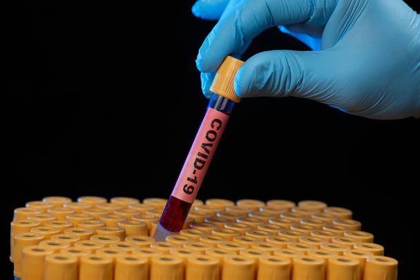Health professional holding blood sample tube for COVID-19 or coronavirus in tray - Photo, Image