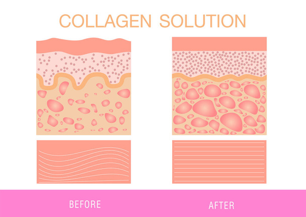 Collagen ,Protection Skin vector. - Vector, Image