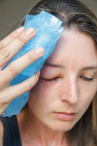 Młoda biała kobieta z opuchniętym okiem od użądlenia osy. Reakcja alergiczna na ugryzienie osy. - Zdjęcie, obraz