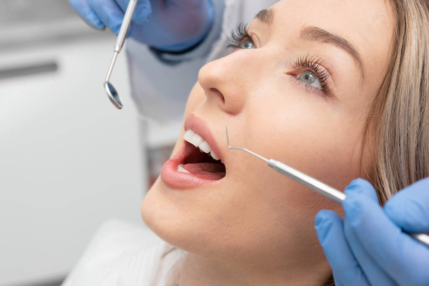 Femme ayant des dents examinées chez le dentiste. Blanchiment des dents, concept de soins dentaires - Photo, image