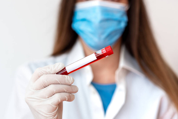Orvosi kesztyűt viselő személy laboratóriumi kísérletekhez. Holding Test Tube of Blood Egészségügyi állapotelemzés - Fotó, kép