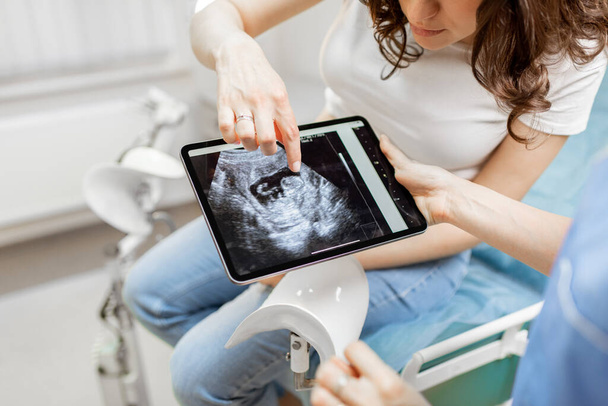 Sanitäter mit einer Ultraschalluntersuchung des ungeborenen Kindes während der Untersuchung - Foto, Bild