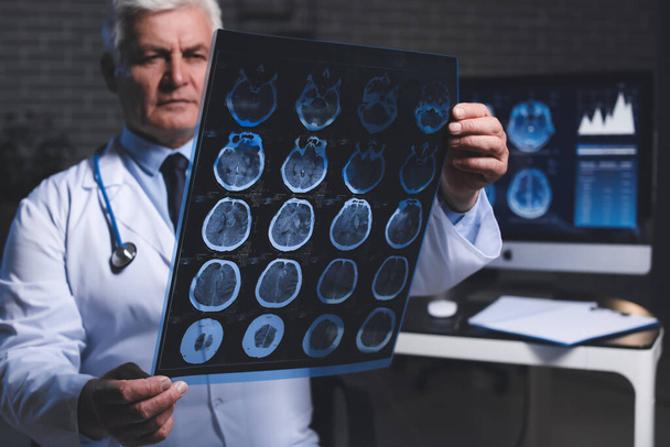 Neurologista sênior com ressonância magnética da cabeça humana na clínica
 - Foto, Imagem